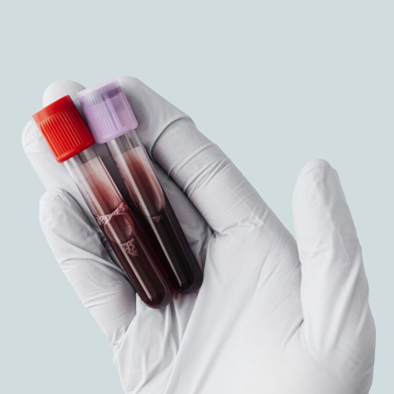 Building Strong Bones Your Comprehensive Guide to Bone Health, mend.zone