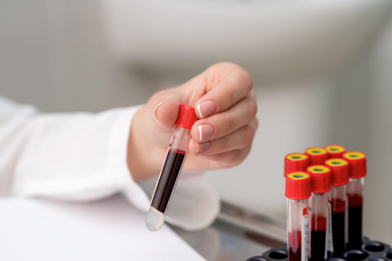 10 Essential Tips for Accurate Blood Test Results