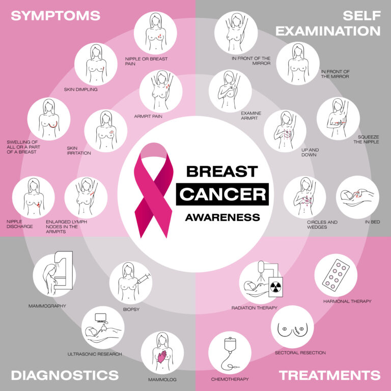 Breast Cancer Symptoms, Self-Examination, Diagnosis & Treatment