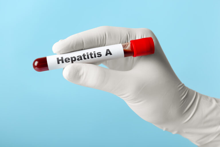 Hepatitis A During Monsoon Symptoms, Diagnosis, Prevention & Home Test Booking